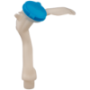 Picture of Washer Reservoir Filler Neck